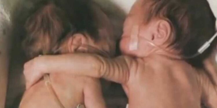 Έβαλε το χεράκι της γύρω από την αδερφούλα της που πέθαινε… Αυτό που συνέβη μετά όμως δεν το περιμέναμε!