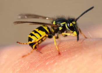 Τι κάνουμε για τσίμπημα μέλισσας και τι για σφήκας (σφίγγας ή σφήγκας). Πώς να αφαιρέσετε το κεντρί; Αντιμετώπιση αλλεργικής αντίδρασης
