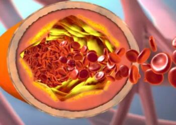 Ο ελληνικός καρπός που μειώνει τριγλυκερίδια, σάκχαρο και χοληστερόλη