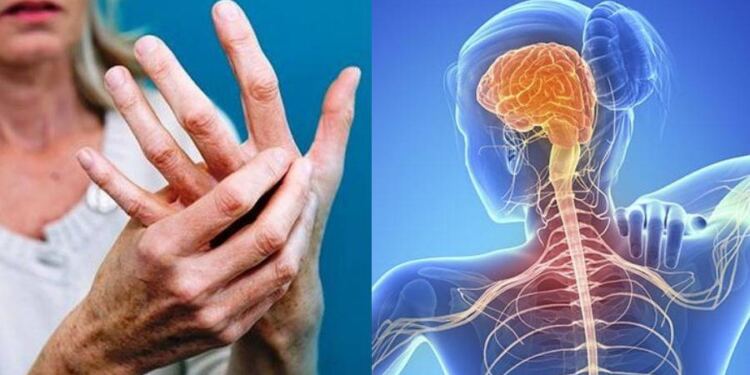 Τα «αθώα» πρώτα πιο κοινά συμπτώματα στην Σκλήρυνση Κατά Πλάκας – Μην τα αγνοήσετε