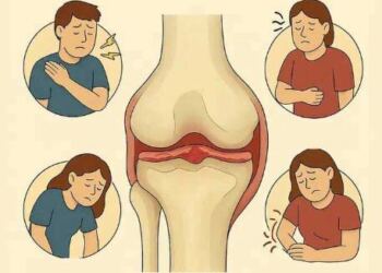 Συμπτώματα οστεοαρθρίτιδας και πώς να την αντιμετωπίσετε