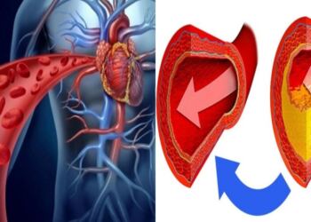 Πώς θα καταλάβετε αν φράζουν οι αρτηρίες σας; Δείτε 4 (τέσσερα) βασικά σημάδια
