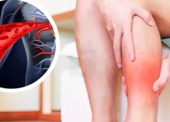 H βιταμίνη που ανοίγει τα αιμοφόρα αγγεία και βελτιώνει την κυκλοφορία