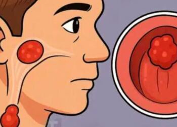 7 σημάδια καρκίνου ρινοφάρυγγα: Ο Νο1 πιο δύσκολος να θεραπευτεί αν δεν ανιχνευθεί έγκαιρα