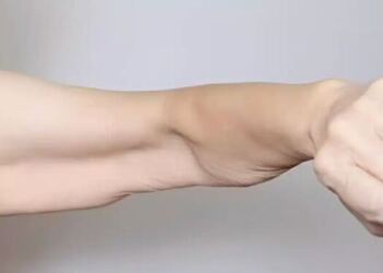 Σαρκοπενία: Αιτίες απώλειας μυϊκής μάζας και λύσεις