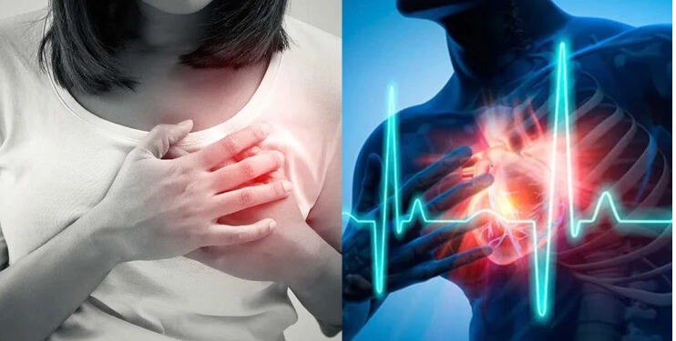 Η ανακοπή καρδιάς δεν εκδηλώνεται τόσο απότομα όσο νομίζουμε – Ποια είναι τα ύποπτα συμπτώματα