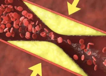 Τα καλύτερα φρούτα για να ξεβουλώσετε και να καθαρίσετε τα αιμοφόρα αγγεία σας